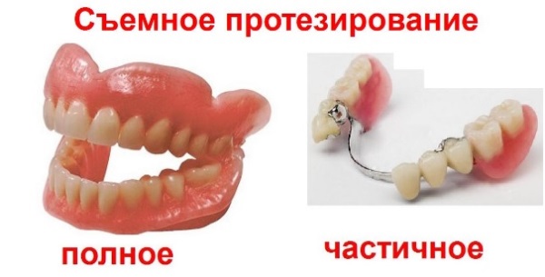 Какая альтернатива имплантации зубов