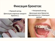 Фиксация брекет систем