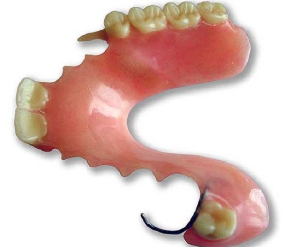 Съемные зубные протезы на верхнюю челюсть фото