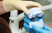 Сколько времени занимает протезирование зубов металлокерамика