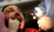 Протезирование после удаления зуба