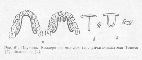 Конструкции с пружиной Коллера