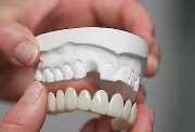 Время протезирования после удаления зубов