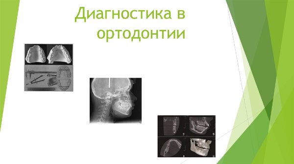 Современные методы диагностики в ортодонтии