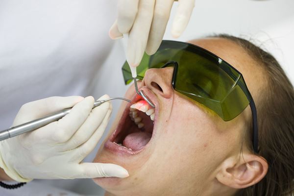 Препарирование зубов под виниры фиксация виниров