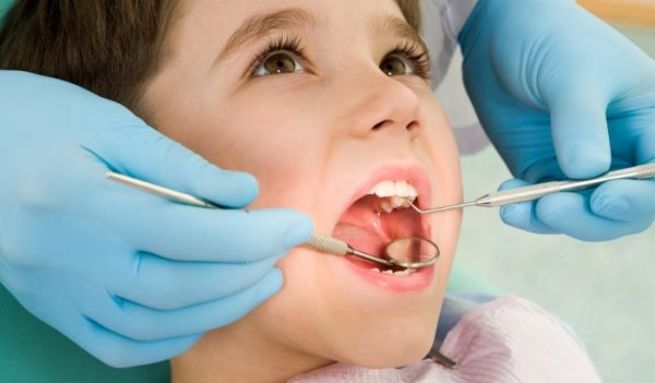 Пломбировочные материалы применяемые в детской стоматологии