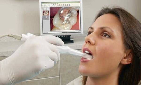 Камеры в стоматологии