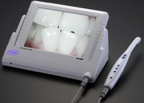 Модели и функции интраоральных камер в стоматологии