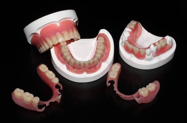 Съемные или несъемные зубные протезы