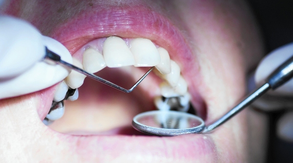 Удаление зуба без стенок