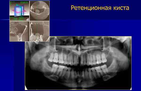 Диагностика патологии