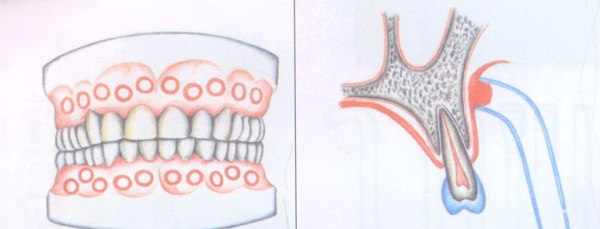 Вакуум терапия в стоматологии