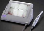 Интраоральная камера в стоматологии