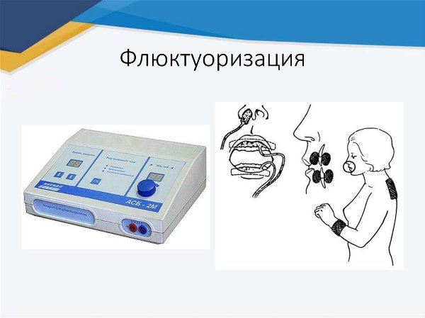 Техника проведения флюктуоризации в стоматологии