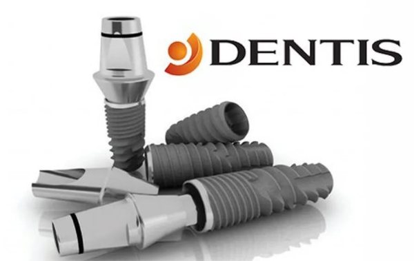 Преимущества имплантов Dentis
