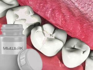 медикаментозные способы уничтожения зубного нерва