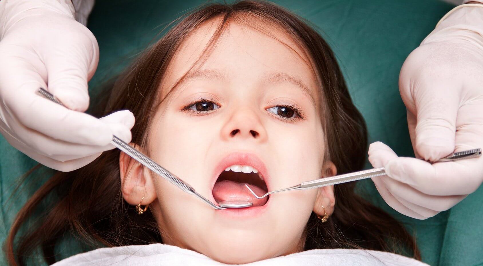 серебрение молочного зуба у ребенка