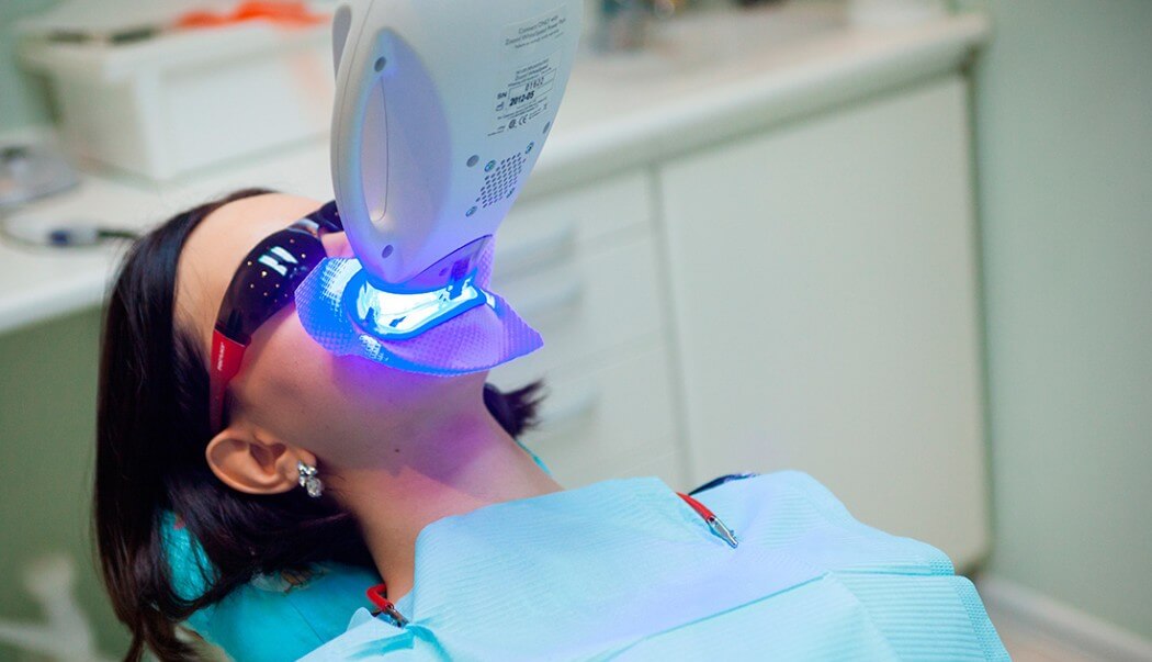 zoom отбеливание зубов отзывы воспользовавшихся пациентов