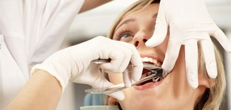 осложнения после проведенного удаления зуба
