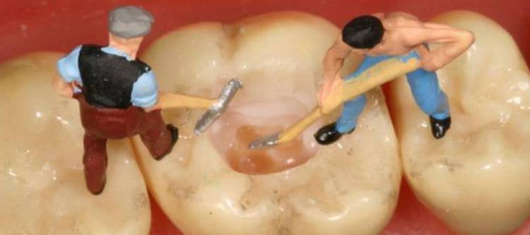 причины разрушения зубов у взрослых и у детей