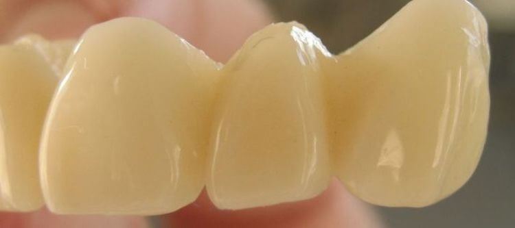 пластмассовые коронки на передние зубы отзывы пациентов стоматологий