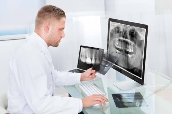 Компьютерная томография в стоматологии противопоказания thumbnail