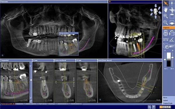 В каком виде получают результаты при компьютерной томографии зубов