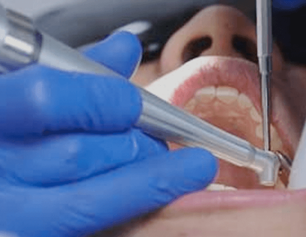 Область применения стоматологической бормашины