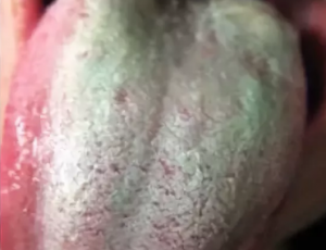 Сухая кожа зеленый язык thumbnail