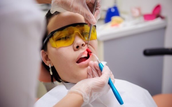Последовательность проведения лазерной имплантации зубов