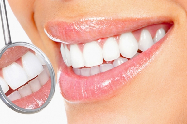 Разновидности методик отбеливания зубов Yotuel
