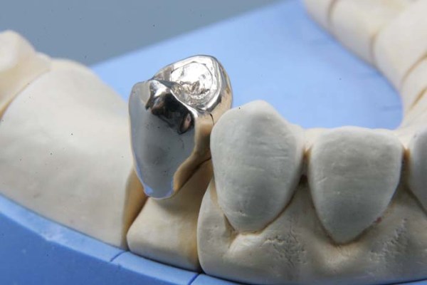 Польза и вред железных зубов thumbnail