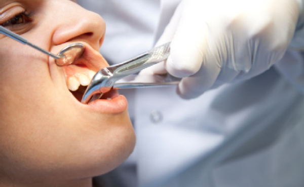 Как избавиться от экзостоза после удаления зуба