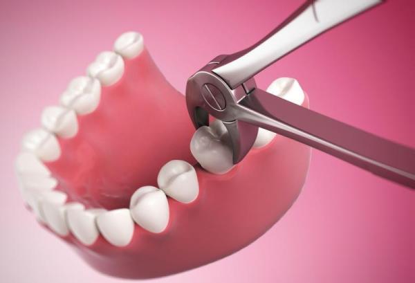 Последствия простого удаления зуба