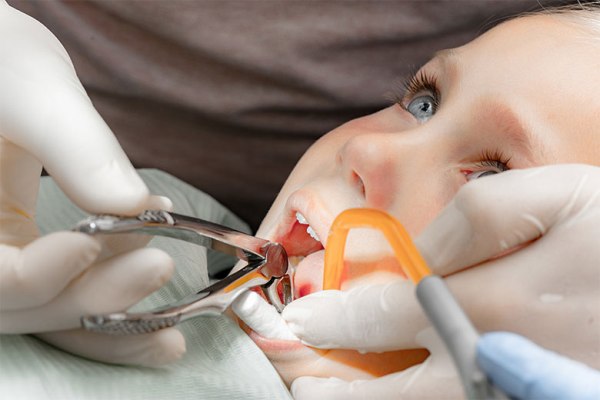 Удаление молочного зуба у ребенка цена