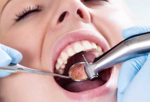 Методы перелечивания зубов и их эффективность