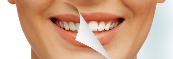 Плюсы и минусы систем отбеливания зубов Bleach N Smile