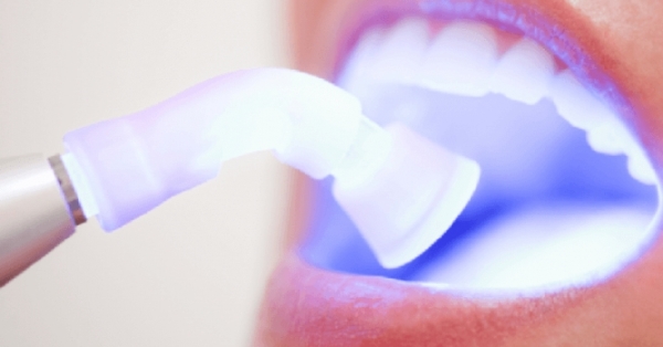 Потемнение зубов возле десен не кариес