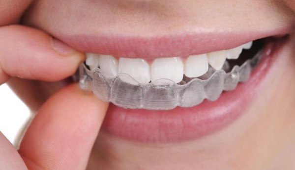 Как выровнять зубы в домашних условиях подростку