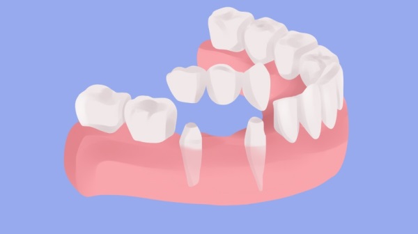 Гепатит с является противопоказанием при имплантации зубов thumbnail