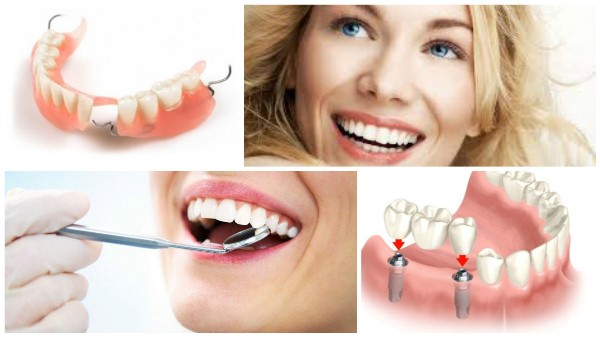 Чем отличается протезирование от имплантации зубов по мнению специалистов