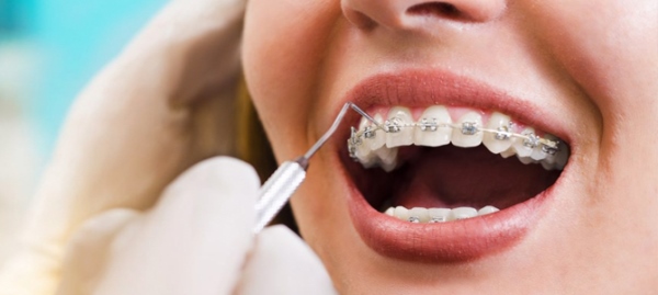 Ортодонтические методы лечения зубов thumbnail