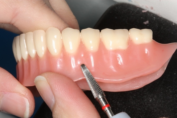 Лечение полости рта после протезирования зубов thumbnail