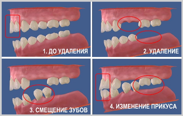 Изменения в челюстной кости