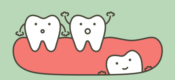 Причины и лечение скученности зубов