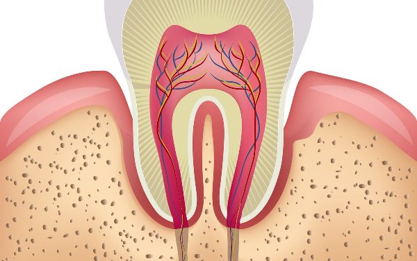 Вскрытие полости интактного зуба