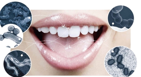 Зубные протезы в развитии кандидоза thumbnail