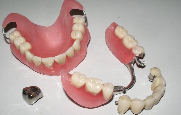 Как понять и какие лучше съемные или несъемные зубные протезы