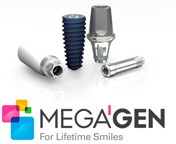 Показания к установке имплантов Megagen